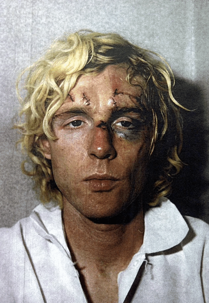 The Night George Harrison Fought for His Life in a Brutal Home Invasion- 2