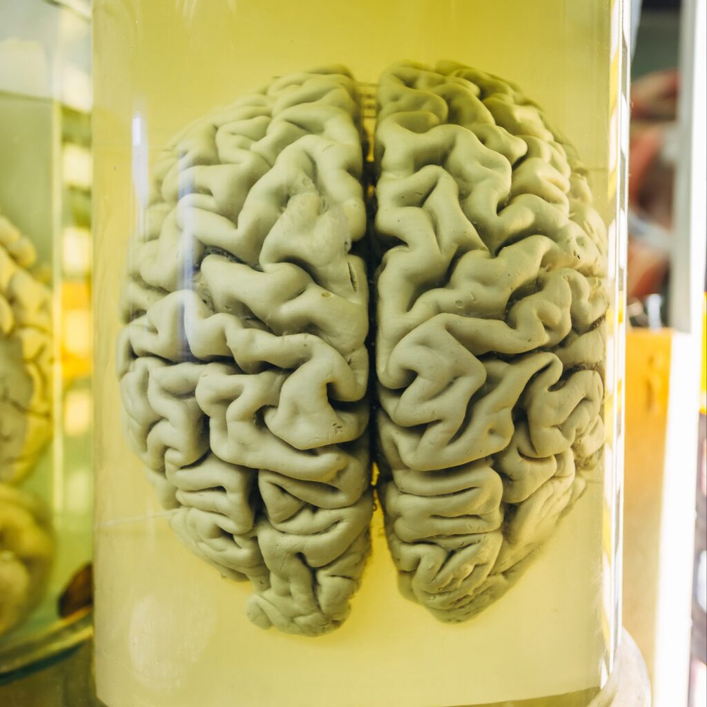 10 Strangest Things Ever Stolen -5