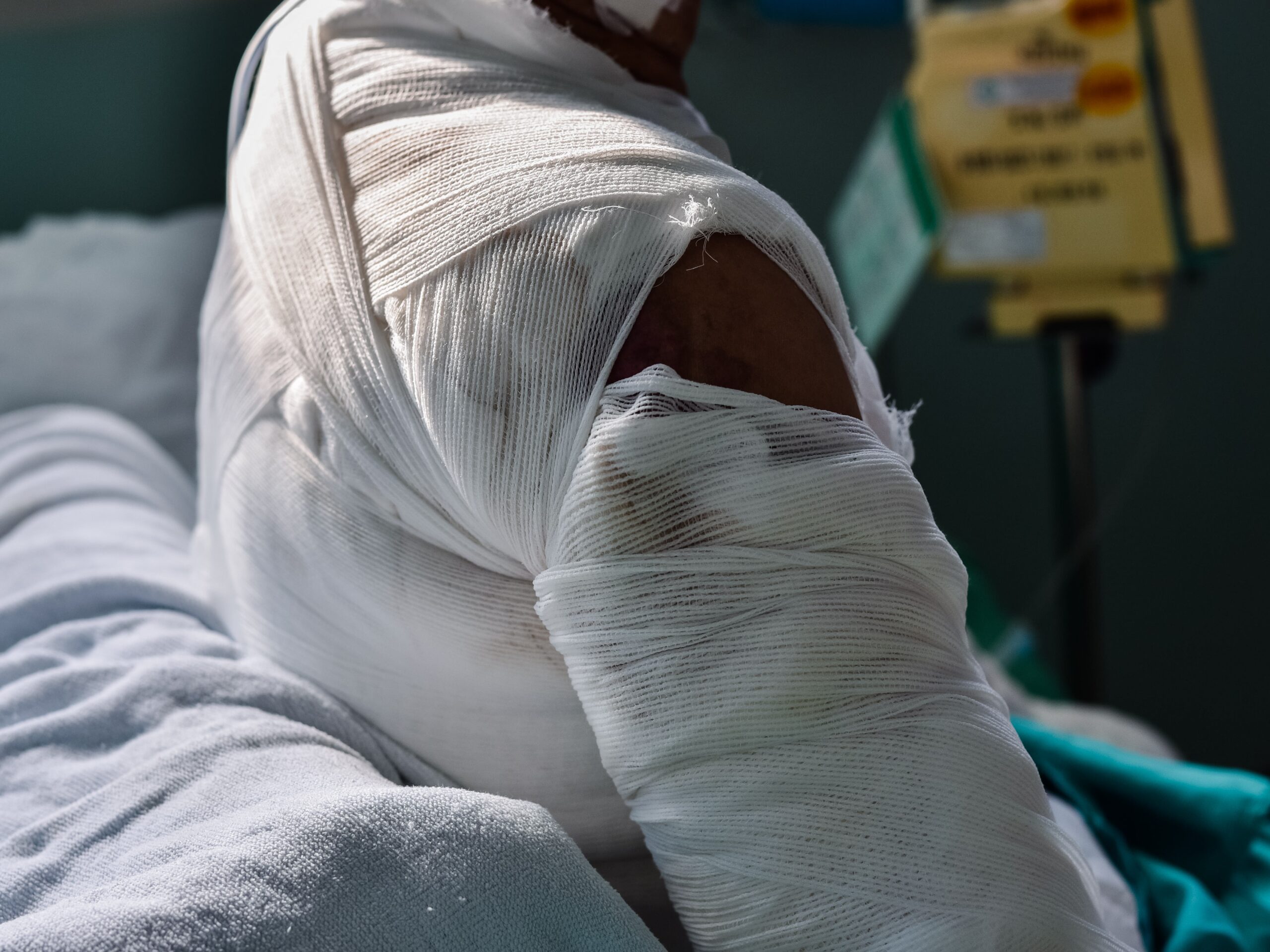 19-Year-Old Set Ablaze in Brutal Family Feud