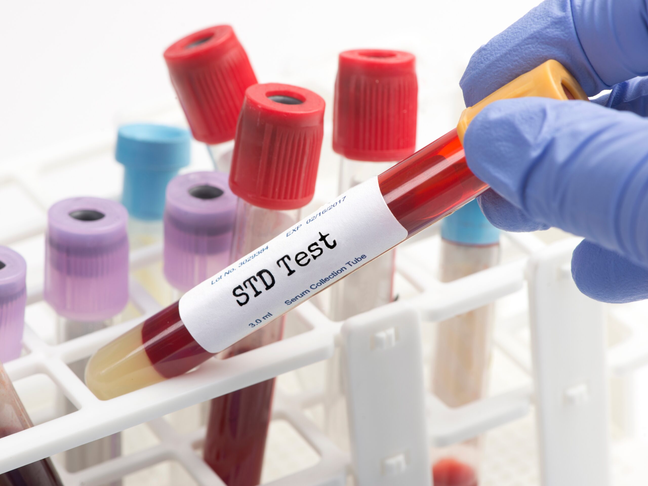 Privileged ‘Nepo‑Baby’ Student Convicted of Killing His Girlfriend